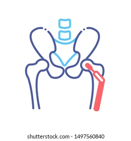 Hip replacement surgery